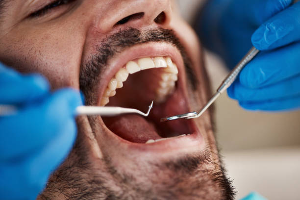 Best Full Mouth Reconstruction  in Silverton, OH